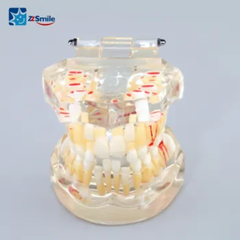 M7015 Dentare Dinti pentru Copii Model Demonstrativ Cu Dentitia Mixta si Radacina Naturala