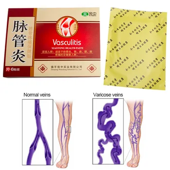 12pcs=2boxes Vene Varicoase Tratamentul Ipsos Varicoase Vasculita Chineză pe bază de Plante de Leac Autocolant Ameliorarea Durerii Medical Patch-uri D2654