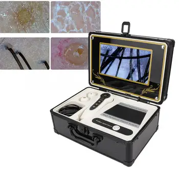 50X 200X Pielea Scalpului Parului Detector Analizor Microscop Profesional de Îngrijire a Pielii Analyser Tool
