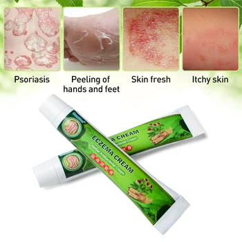 3pcs Ierburi Chinezești Antibacterian Crema Profesionale Piele Unguent Pentru Eczeme, Dermatită, Prurit, Psoriazis Ipsos Medical D2613