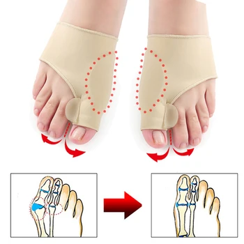 1Pair Mare Osoase Ortopedice Inflamație la picior de Corecție Șosete Pedichiura Inflamație la picior Atelă Tep Separator care se Suprapun Distribuitor Corector Picior de Îngrijire