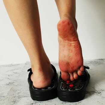 Acupoint Masaj Papuci Barbati/Femei Sandale Picioare Chineză Presopunctura, Terapia Medicală Rotative de Masaj pentru Picioare Pantofi Barbati Unisex